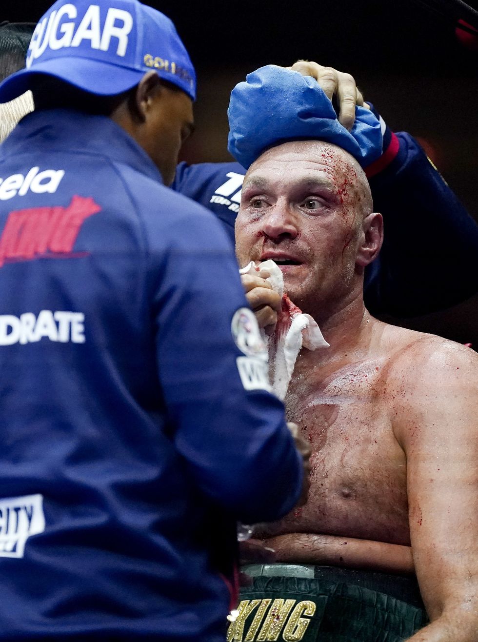 Boxing news Tyson Fury