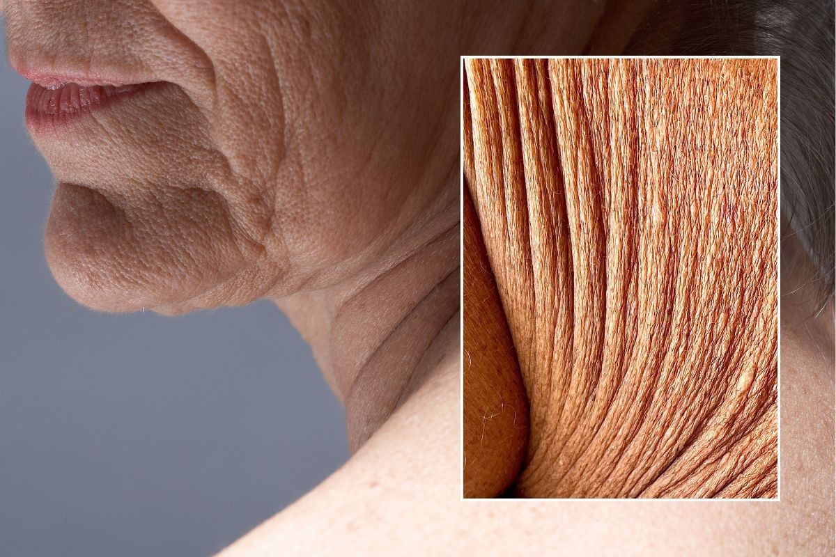 Crepey skin on older woman 