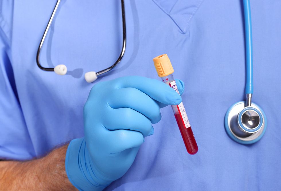 Doctor holding a blood test