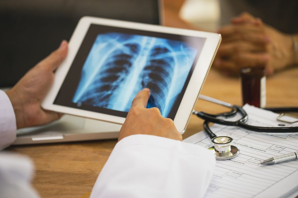 Doctor with image of lungs