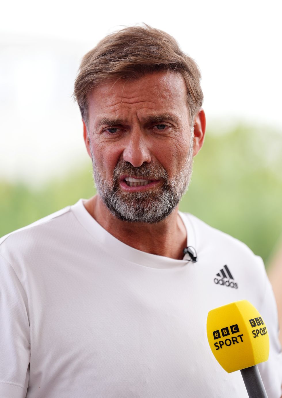 Jurgen Klopp