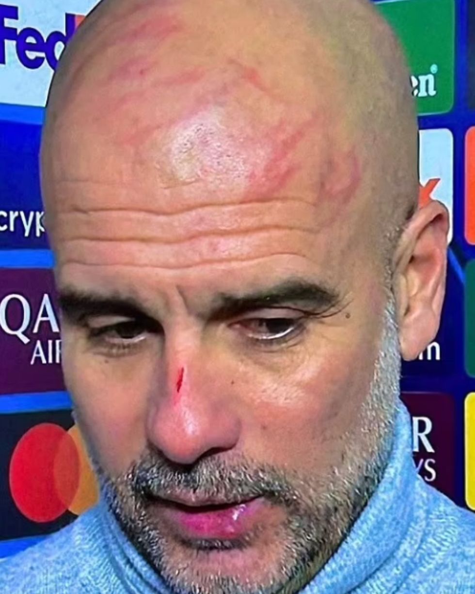 Man City Pep Guardiola Feyenoord