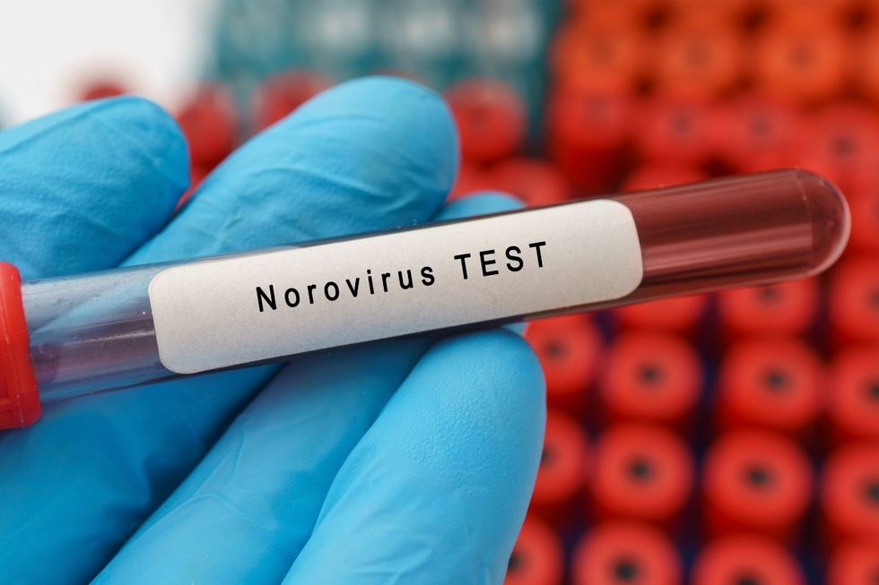 Norovirus test