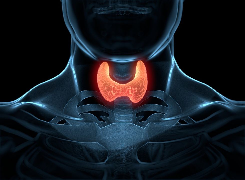 Thyroid cancer