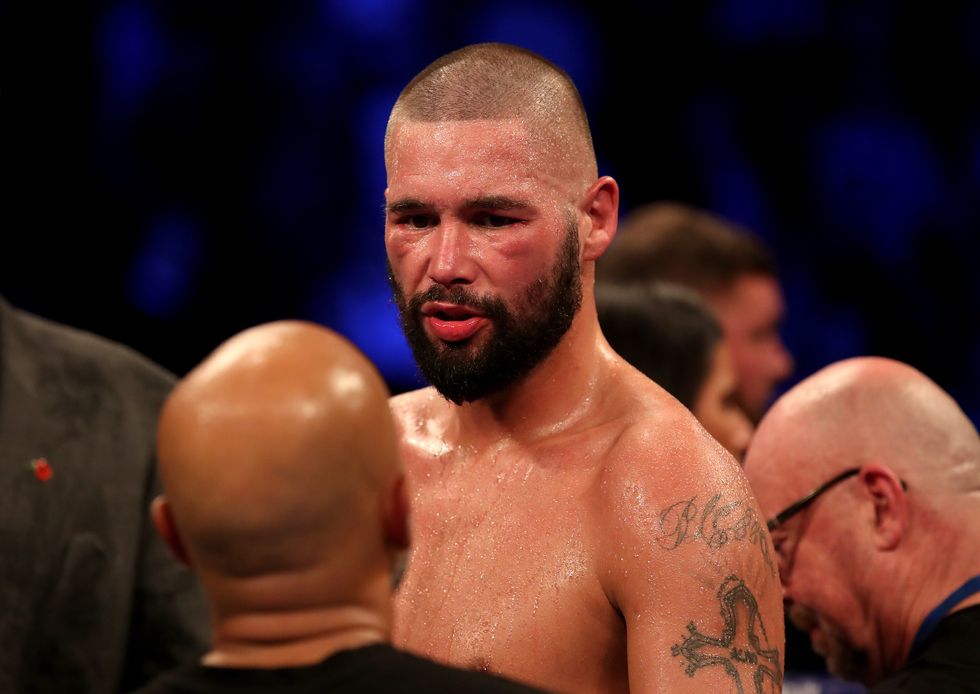 Tony Bellew