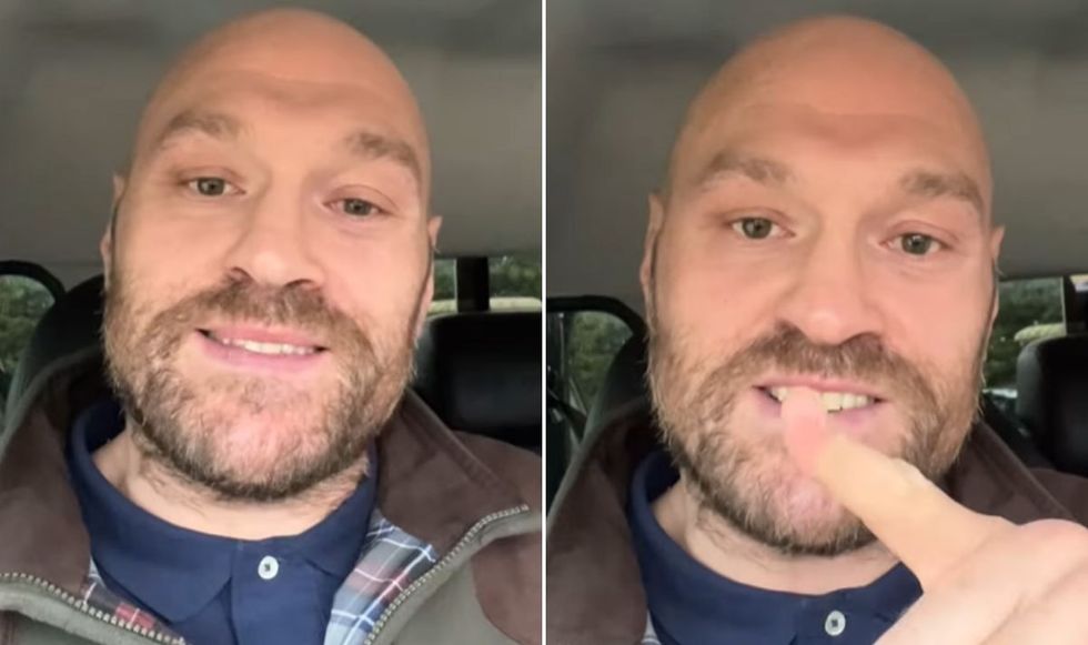 Tyson Fury