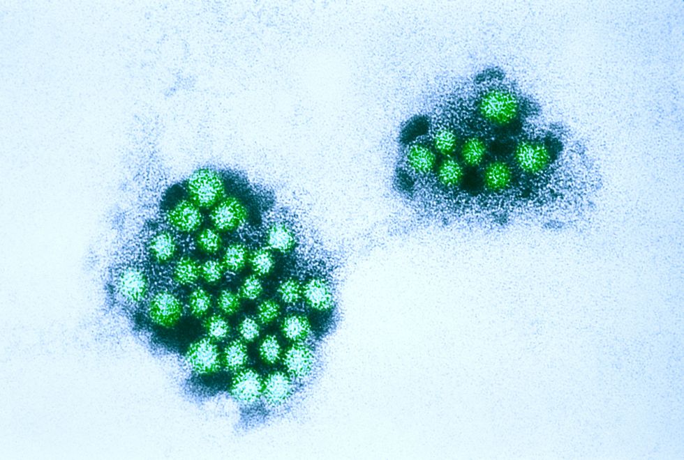 u200bAn electron micrograph of the Norwalk virus