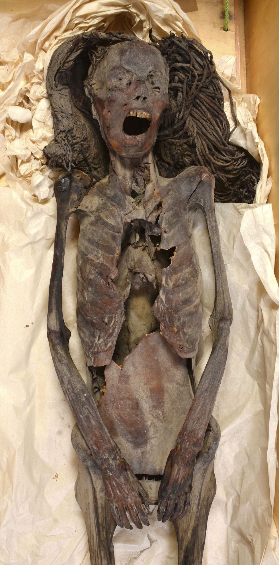 u200bThe "Screaming Woman" mummy, discovered in 1935 at Deir Elbahari near Luxor and dating to about 1500 BC