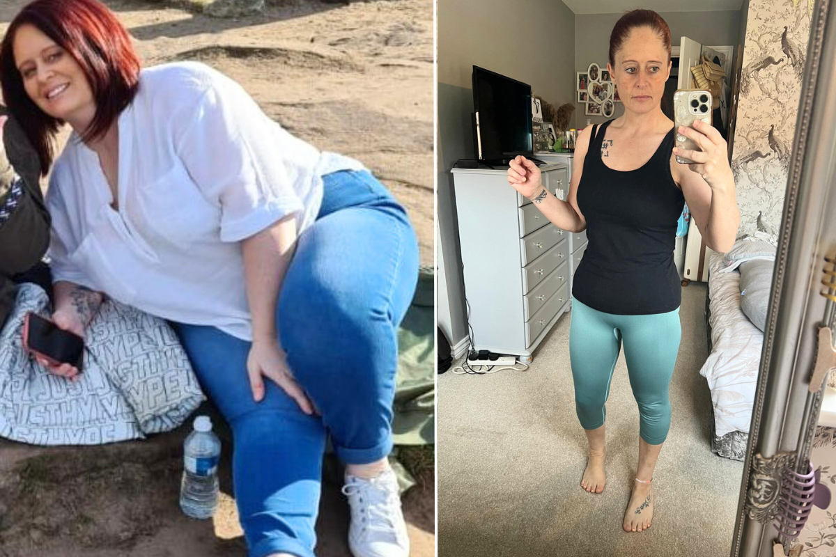 Woman before / after weight loss 