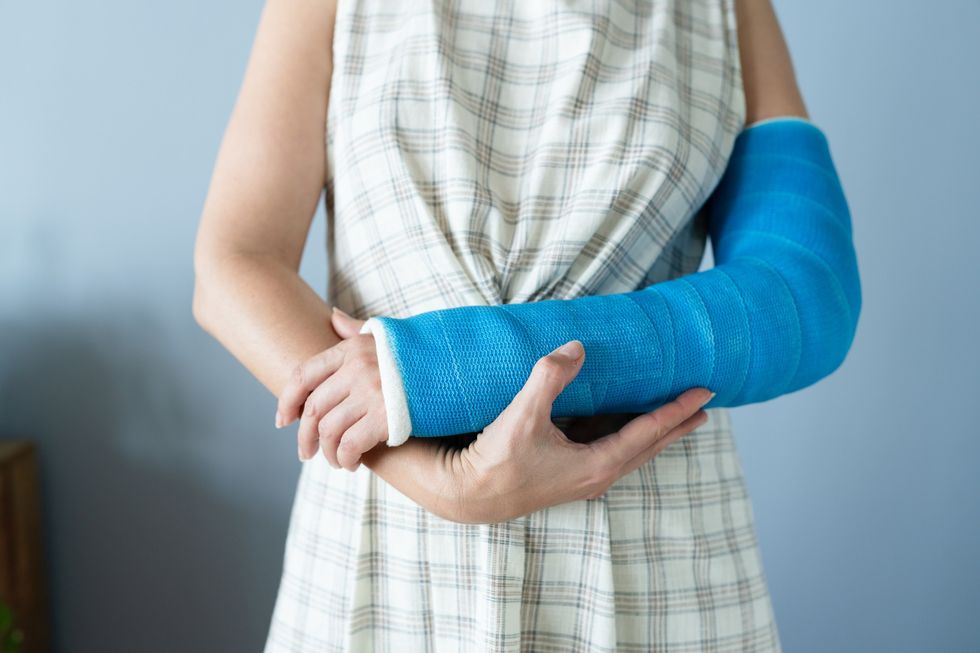 Woman with cast on arm